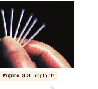 Figure 3.3 Implants